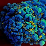 ​Światowy Dzień AIDS. Dlaczego nie mamy szczepionki przeciwko wirusowi HIV?