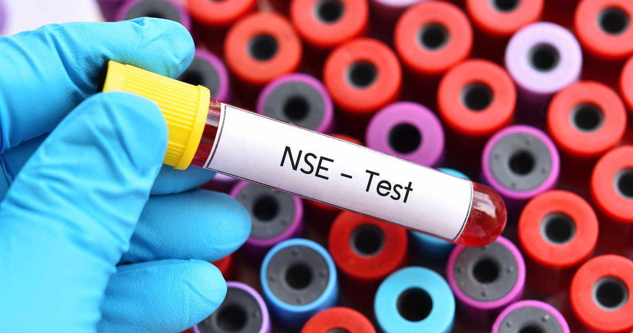 Swoista enolaza neuronowa (NSE) to marker oznaczany w podejrzeniu nerwiaka zarodkowego /123RF/PICSEL