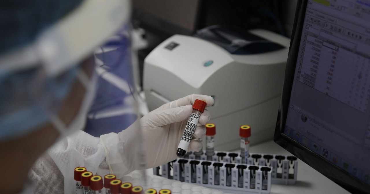 Sygnał alarmowy: Nawet 5 procent przypadków koronawirusa w Polsce to mutacja brytyjska. Bardziej zaraźliwa