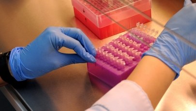 System ochrony przed HIV jest nieszczelny. "Badania zleca mniej niż 30 proc. lekarzy"