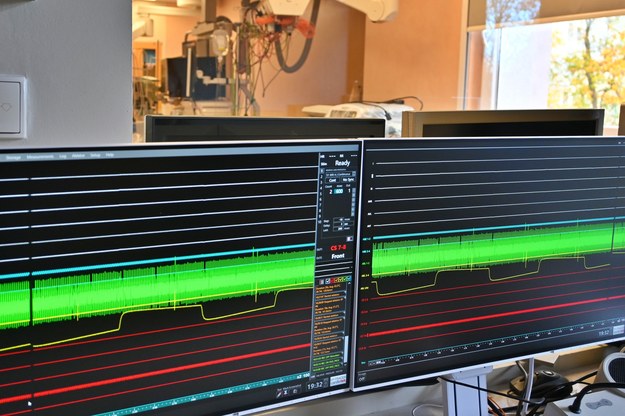 System pozwoli specjalistom z SPWSZ na wykonywanie badań elektrofizjologicznych serca z jeszcze większą precyzją. /Szpital Wojewódzki w Szczecinie /