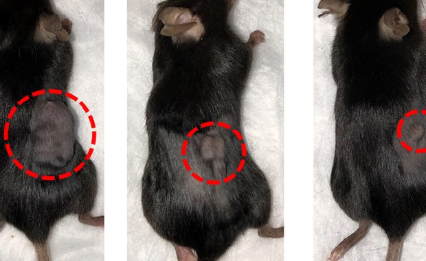 Szansa dla chorych na nowotwory? Naukowcy o optymistycznych wynikach badań