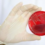 Szczecin: Trzeci pacjent z podejrzeniem zakażenia bakterią coli