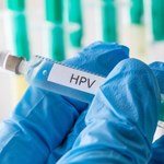 Szczepienia HPV warto wprowadzić jak najszybciej