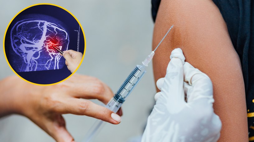 Szczepienia przeciwko grypie mogą zmniejszyć ryzyko wystąpienia udaru mózgu /123RF/PICSEL