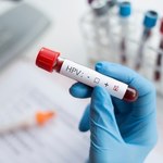 Szczepienia przeciwko HPV - wyniki badań są obiecujące