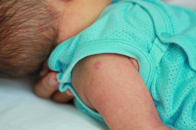 Szczepionka BCG podawana jest 24 godziny po narodzeniu się dziecka /123RF/PICSEL