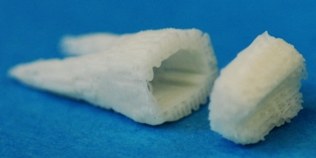 Szkielet nowego zęba, projekt doktora Jeremy'ego Mao &nbsp; /Columbia University Medical Center