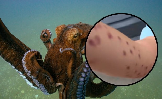 Szokujące sceny w oceanarium. Ośmiornica zaatakowała 6-latka? 