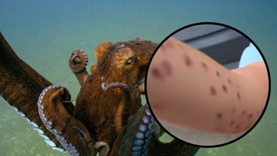Szokujące sceny w oceanarium. Ośmiornica zaatakowała 6-latka? 