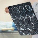 Szokujące zdjęcie – pasożyt w głowie pacjenta. Ratownik medyczny ostrzega