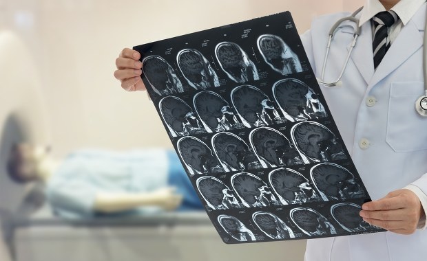 Szokujące zdjęcie – pasożyt w głowie pacjenta. Ratownik medyczny ostrzega