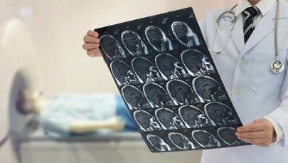 Szokujące zdjęcie – pasożyt w głowie pacjenta. Ratownik medyczny ostrzega