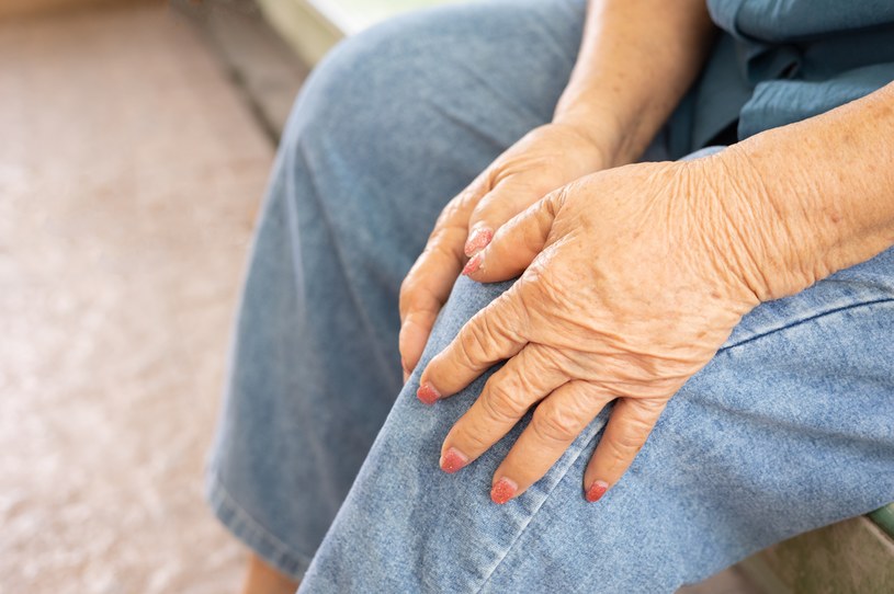 Szpiczak mnogi to złośliwy nowotwór szpiku kostnego. Najczęściej dotyka osoby starsze, choć notuje się zachorowania poniżej 55. roku życia /123RF/PICSEL