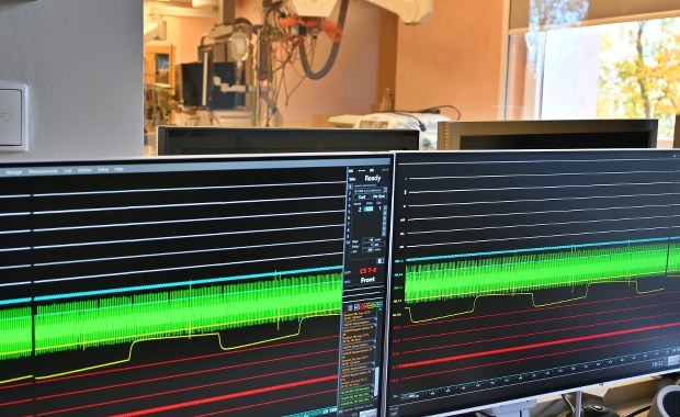 Szpital ma nowoczesny system do diagnostyki i leczenia zaburzeń rytmu serca 