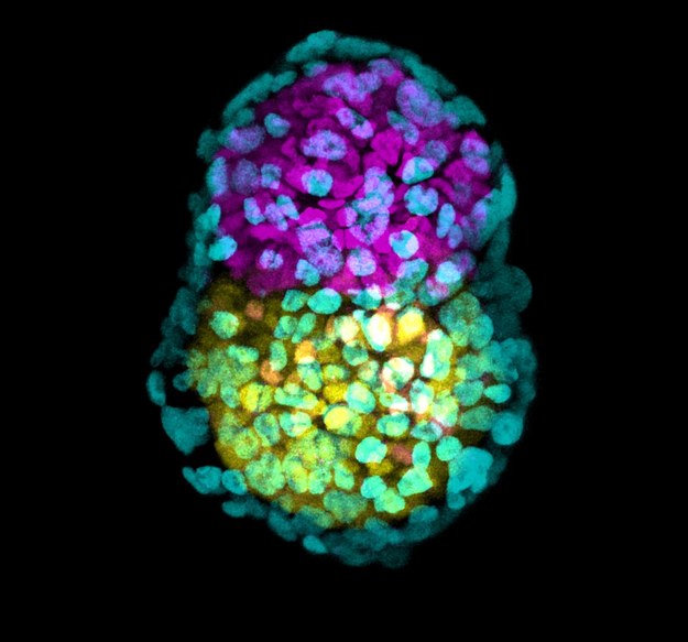 Sztuczny zarodek stworzony z trzech rodzajów komórek macierzystych, oznaczonych na zółto, zielono i różowo /Zernicka-Goetz  lab,  University  of  Cambridge   /Materiały prasowe