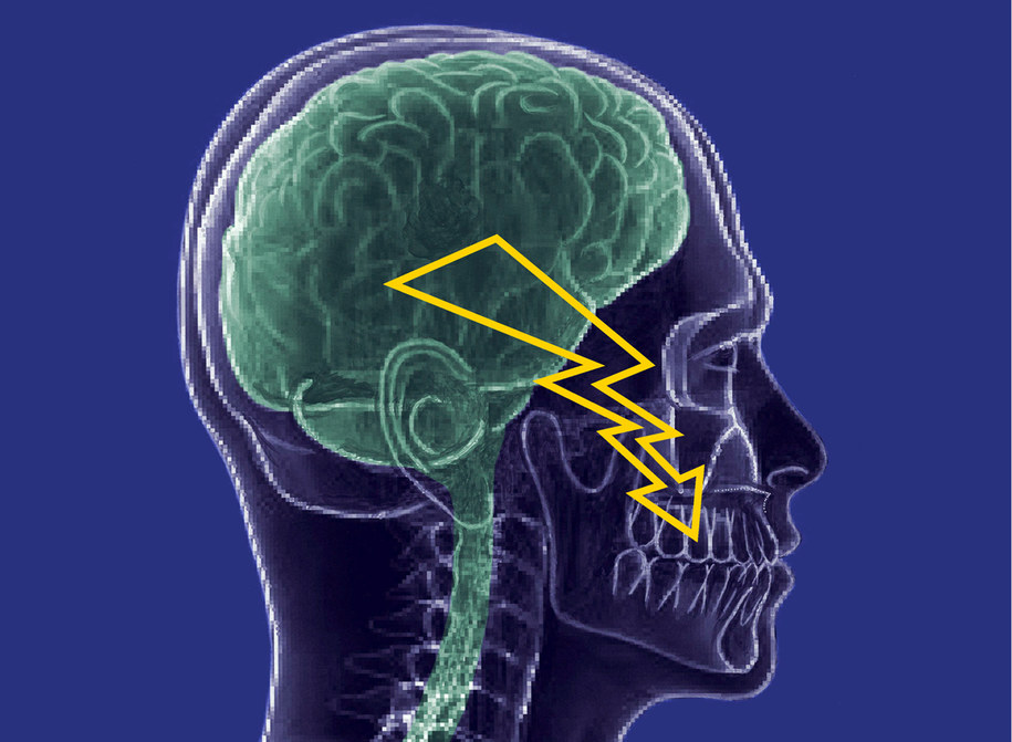 Szwajcarscy naukowcy testują substancję, która może pomóc cierpiacym na neuralgię nerwu trójdzielnego /Center of Dental Medicine; UZH /materiały prasowe