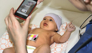 Ta aplikacja rozpozna żółtaczkę u noworodka