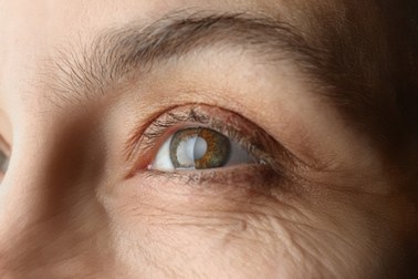 Ta choroba oczu dotknie większość z nas. Można stracić wzrok!