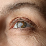 Ta choroba oczu dotknie większość z nas. Można stracić wzrok!
