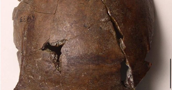 Ta czaszka liczy sobie 6000 lat /fot. ARTHUR DURBAND /materiały prasowe