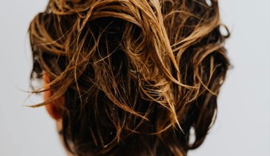 Ta prosta wcierka ziołowa powstrzymał moje wypadanie włosów w tydzień. Hit dla kobiet 40+