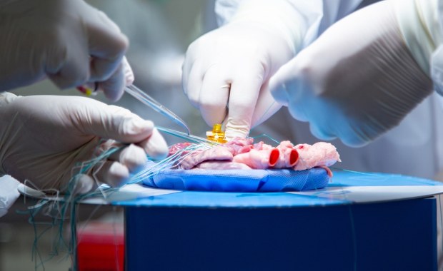 Tajemnice ludzkich narządów. Jakie organy są nam niepotrzebne? 