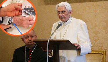Tajemnicza opaska na ręce zmarłego Benedykta XVI. Co to za urządzenie?