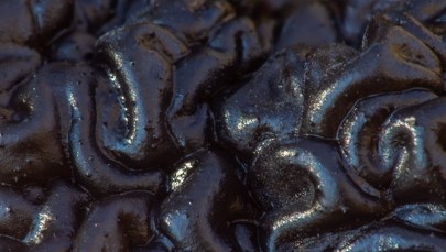 Tajemniczy grzyb, który przypomina ludzki mózg