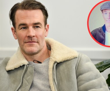 Tak dziś wygląda James Van Der Beek. Walczy z ciężką chorobą