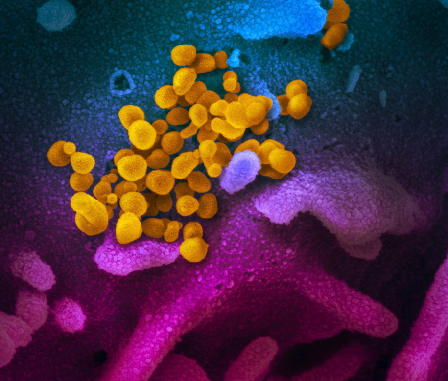 Tak pod mikroskopem elektronowym wygląda wirus SARS-CoV-2, znany również jako 2019-nCoV /National Institutes of Health /PAP/EPA