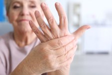 Tak sprawdzisz poziom cholesterolu. Wystarczy prosty "test ręki"!