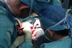 Tak wygląda pacjentka po przeszczepie twarzy [Uwaga, drastyczne zdjęcia!]