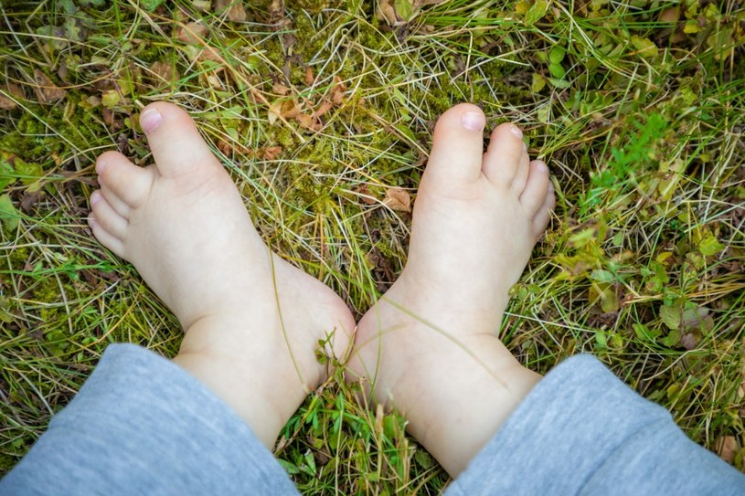 Tak wyglądają stopy wielu osób z zespołem Downa /123RF/PICSEL