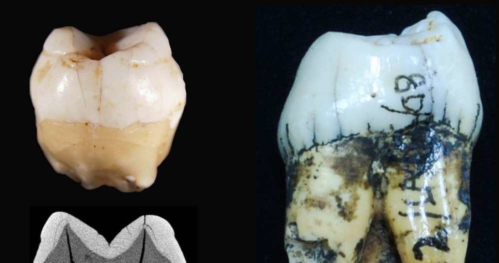 Tak wyglądają zęby odnalezione na Sumatrze /materiały prasowe
