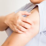 Tak zdemaskujesz zakażenie grzybicze. Kiedy i jak badać się na kandydozę?