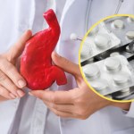 Takie leki gastrolog zleci na refluks lub wrzody. Po połknięciu odczekaj z jedzeniem