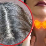 Takie włosy to objaw chorej tarczycy lub serca. Dotknij, przeczesz i oceń 