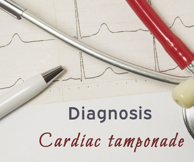 Tamponada serca: Przyczyny, objawy i leczenie