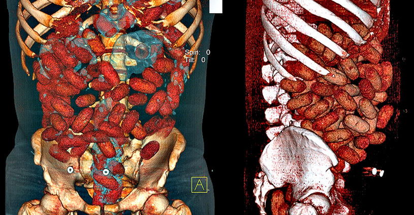 Te zdjęcia zostało zrobione trójwymiarowym tomografem. Możecie zobaczyć jak wyglądają połknięte kapsułki z kokainą w ciele "muła" /materiały prasowe