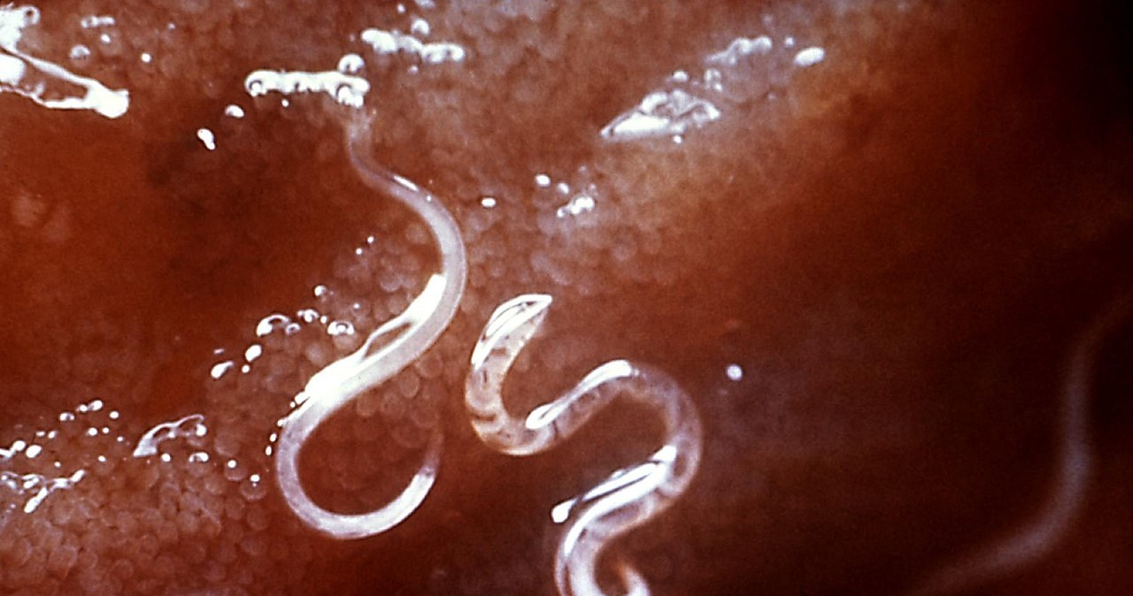 Tęgoryjce Ancylostoma caninum przyczepione do błony śluzowej jelita /Wikimedia Commons/ Centers for Disease Control and Prevention's Public Health Image Library /domena publiczna
