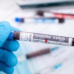 Ten kraj zmaga się z epidemią wirusa Marburg. WHO o ryzyku zakażeń na świecie