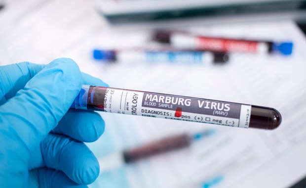 Ten kraj zmaga się z epidemią wirusa Marburg. WHO o ryzyku zakażeń na świecie