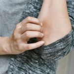 Ten objaw może sugerować niedobory ważnej witaminy. Skąd biorą się siniaki na ciele?