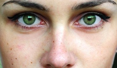 Ten pieprzyk to nie przypadek. 90 procent ludzi ignoruje ten znak