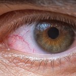 Ten sposób dezynfekcji koronawirusa może popsuć wzrok