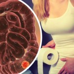 Tenesmus jako objaw nowotworu jelita grubego