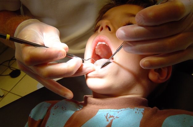 Terapia laserowa może odmienić sposób, w jaki leczymy zęby. /stock.xchng
