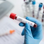 Test jest darmowy, anonimowy i szybki. HIV można leczyć, jeśli zakażenie wykryje się szybko