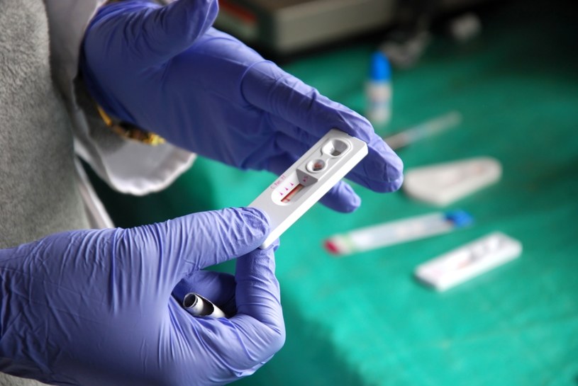 Test na HIV powinien zrobić każdy, kto choć raz podjął jakiekolwiek ryzykowne działanie w sferze intymnej lub wstrzykiwał sobie narkotyk za pomocą używanego sprzętu /123RF/PICSEL